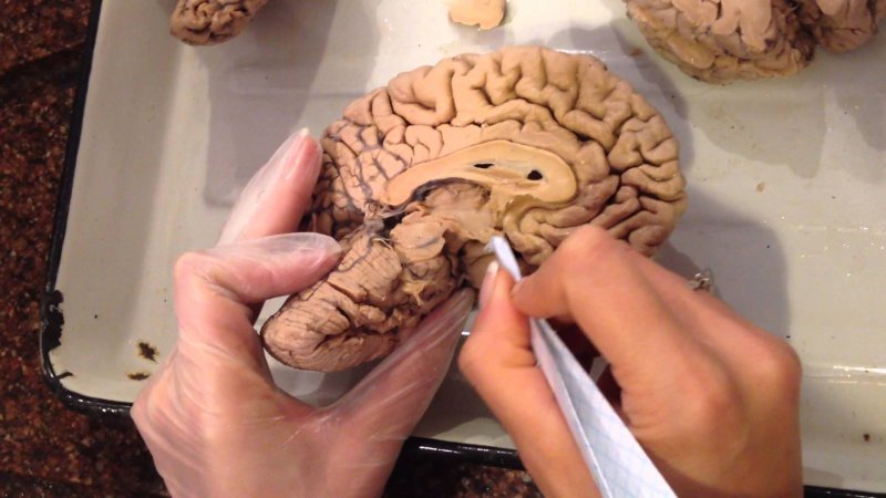 Человеческий мозг живой