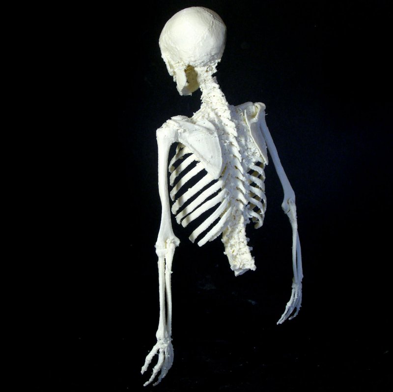 Квадратный скелет