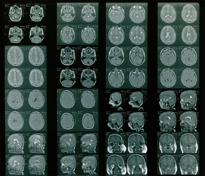 Поделки из рентгеновских снимков мастер класс