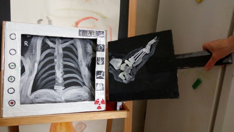 Интересные рентгеновские снимки