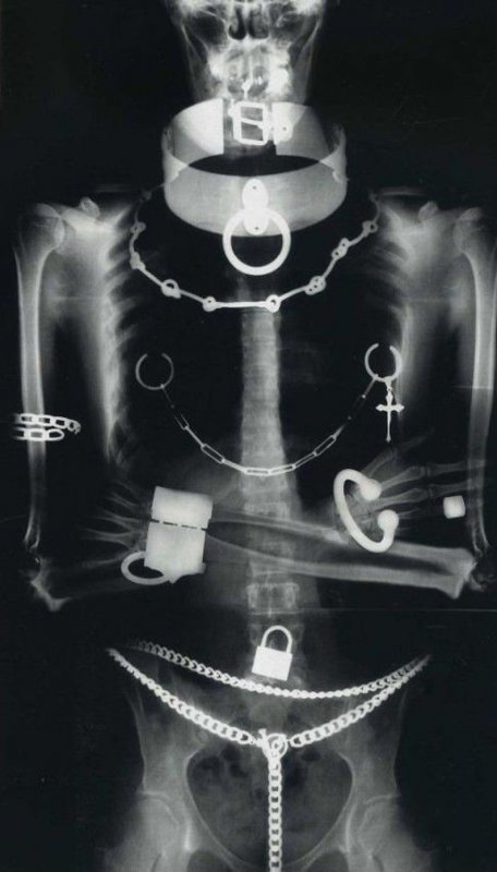Рентген обложка