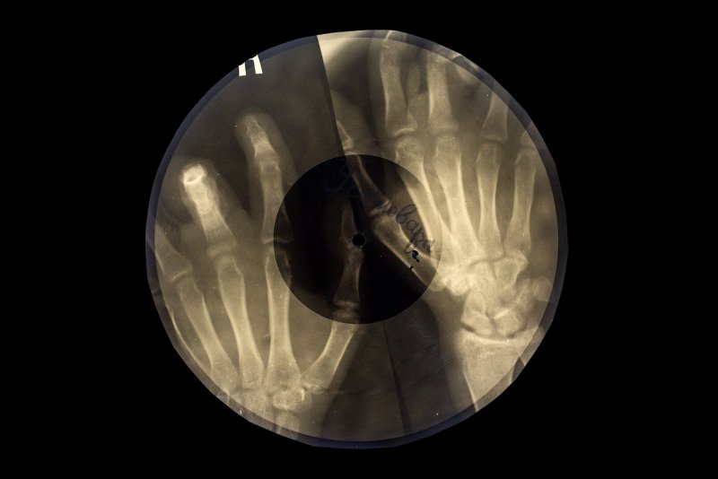 Рентгеновский снимок стилизация