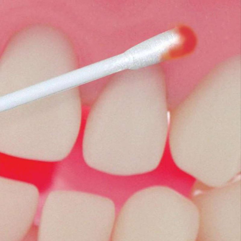Аппликационная анестезия в стоматологии препараты