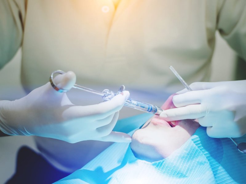 Анестезия в стоматологии
