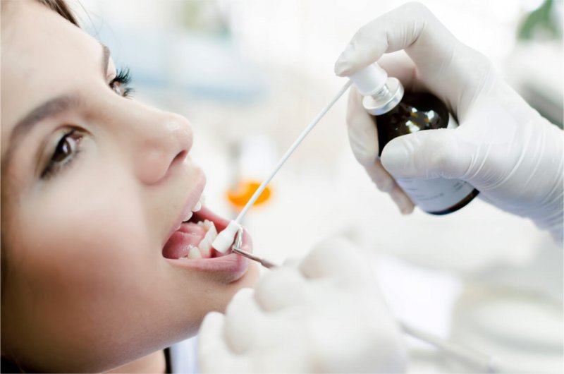 Средство для анестезии слизистой оболочки полости рта