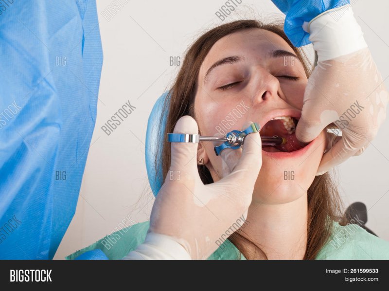 Местное обезболивание в стоматологии