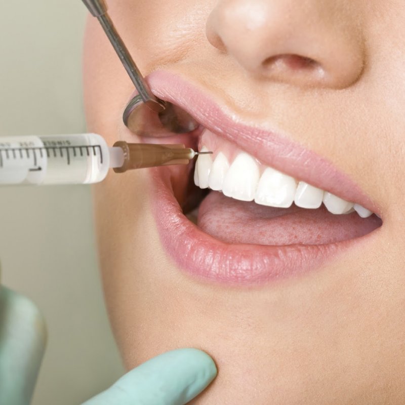 Плазмолифтинг в стоматологии