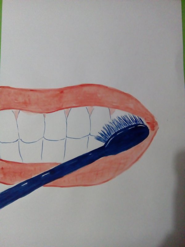 Зубки с брекетами рисунок