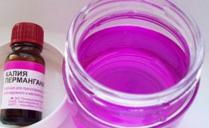 Обработка пупка маргонцовкой